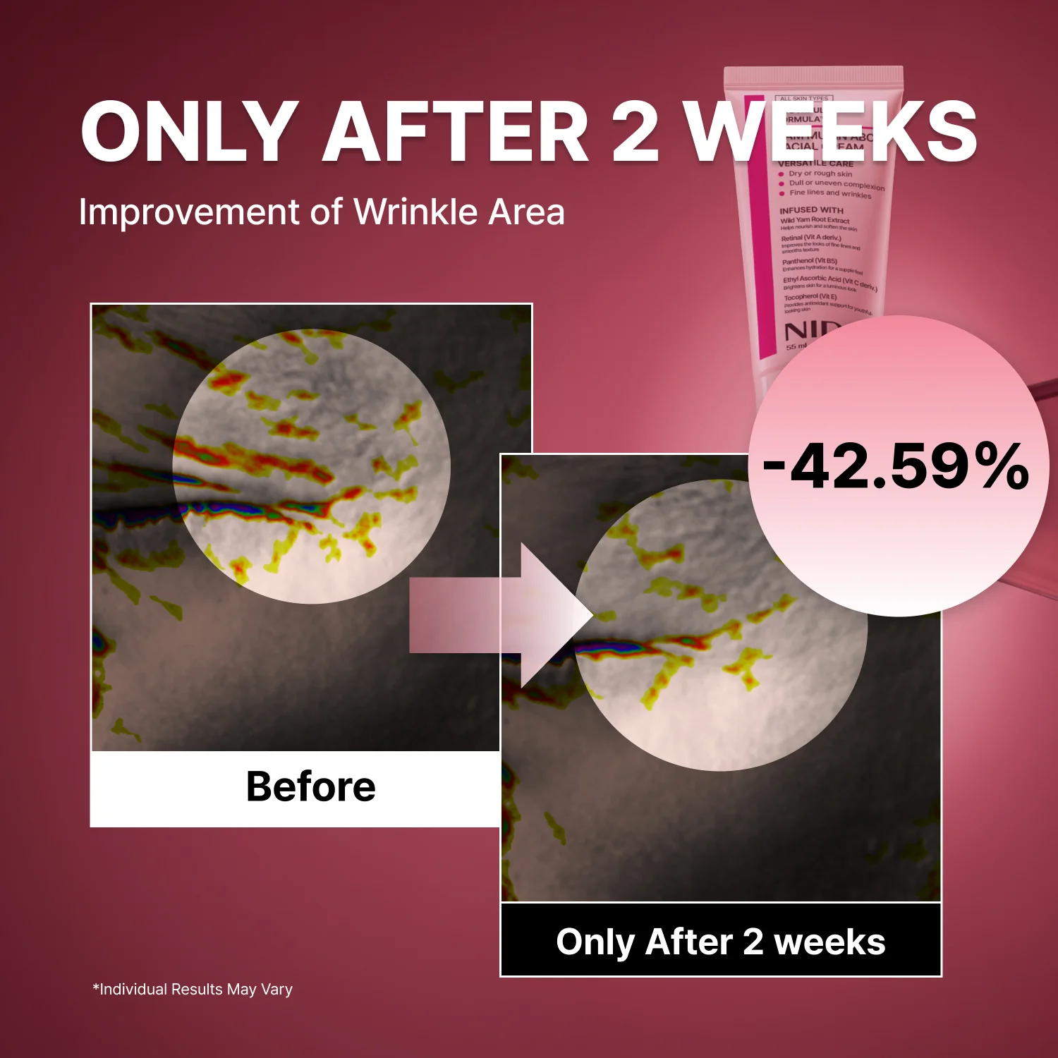 NIDA Youthful Formula™ Yam Mucin ABCE Facial Cream - Image 3