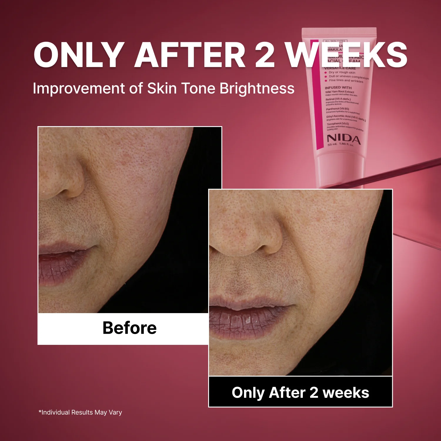 NIDA Youthful Formula™ Yam Mucin ABCE Facial Cream - Image 4