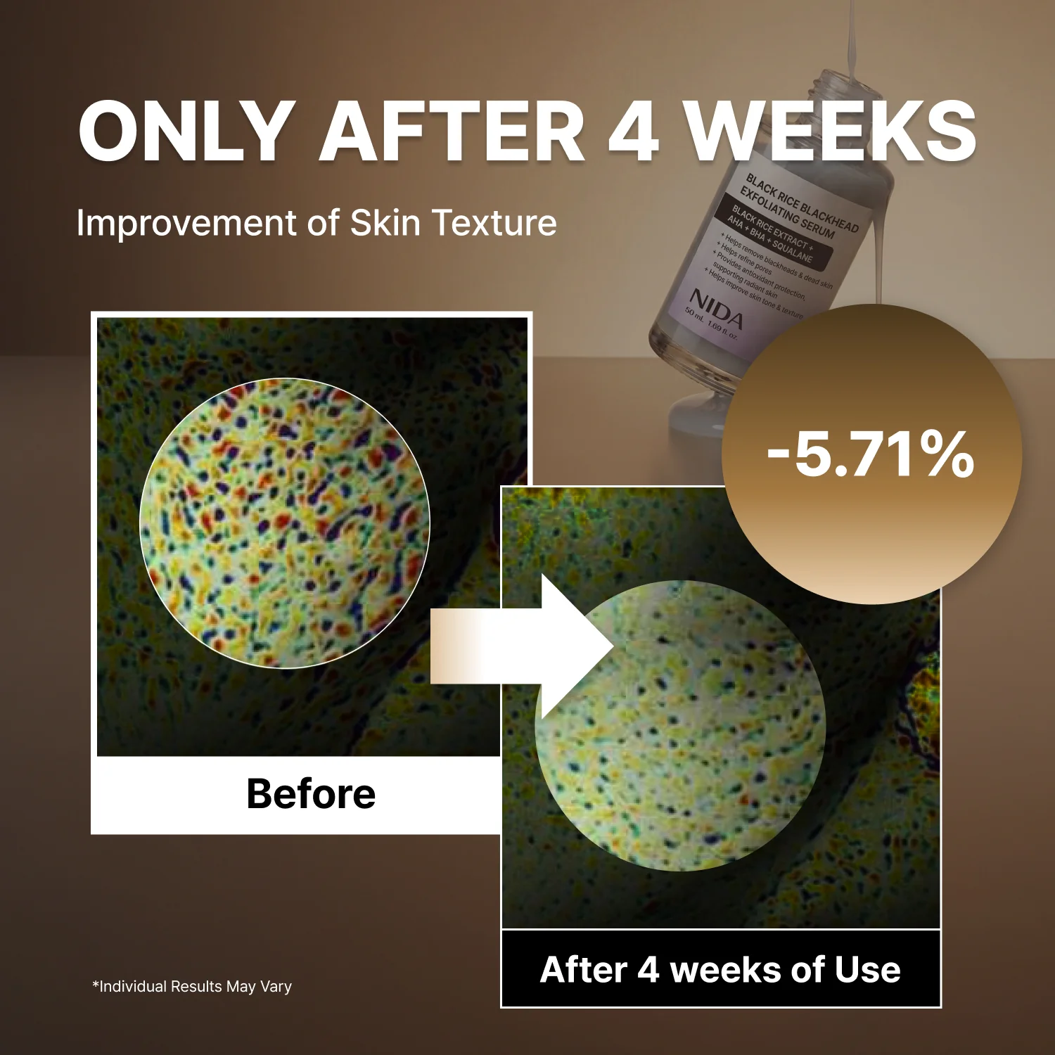 NIDA White Black Exfoliating Serum Duo Bundle - Image 14