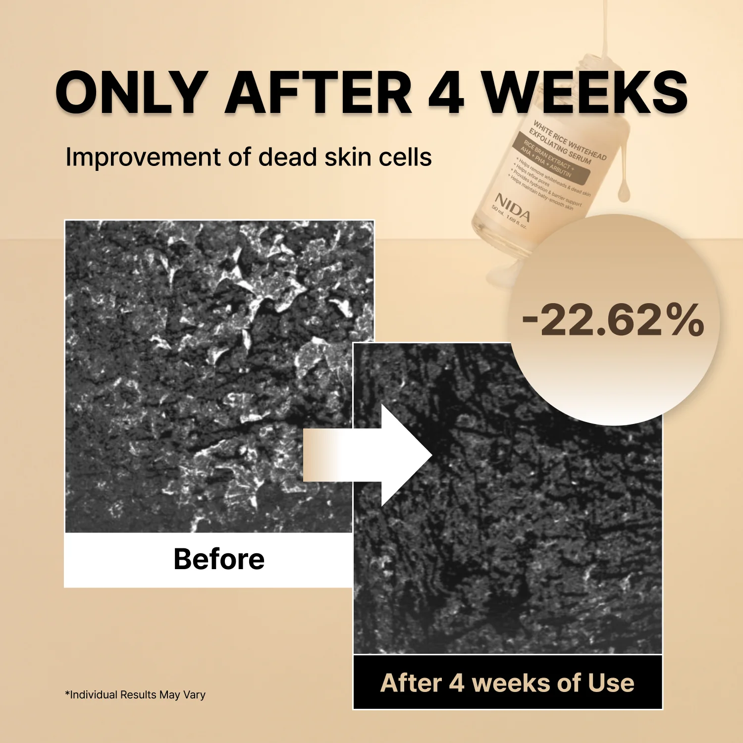 NIDA White Black Exfoliating Serum Duo Bundle - Image 5