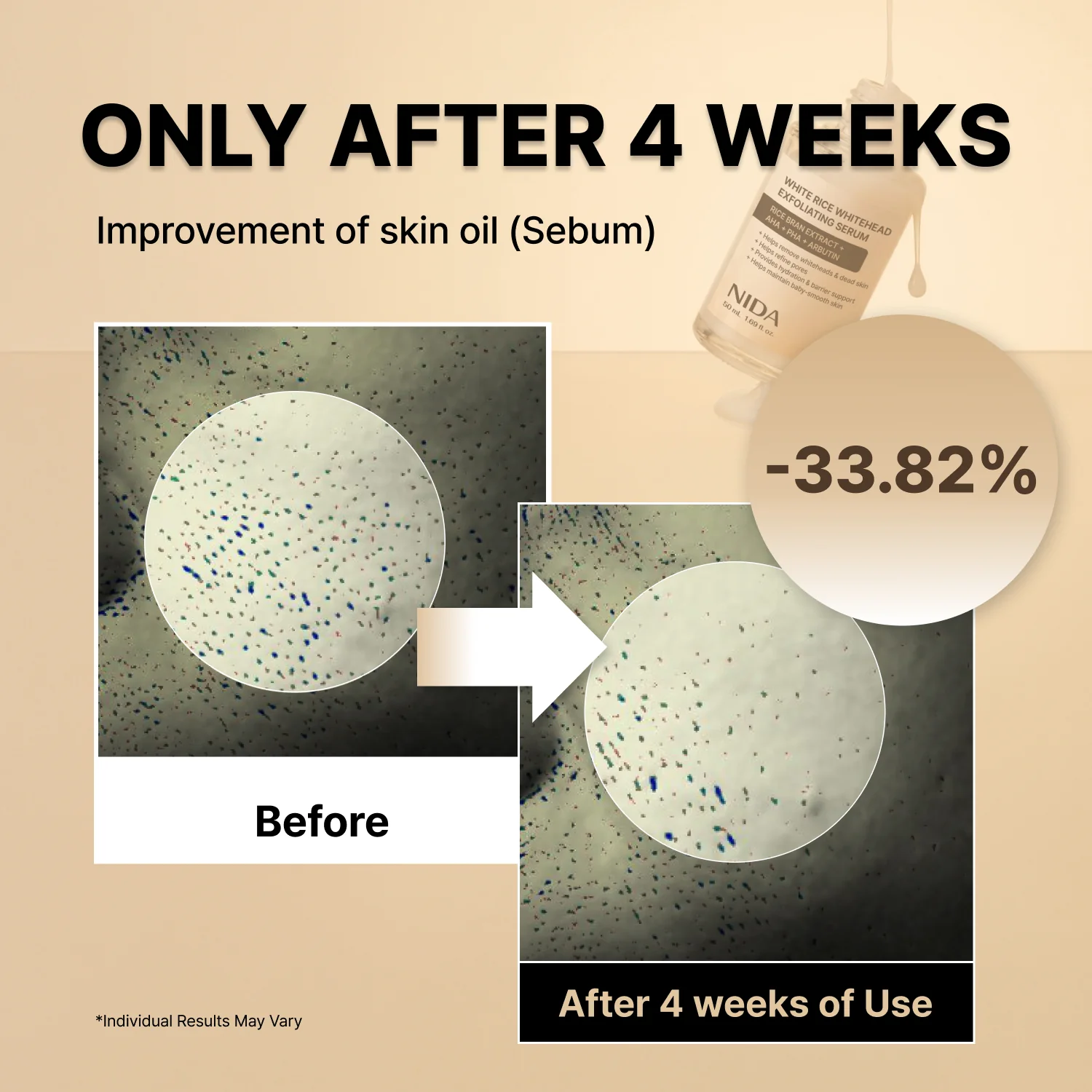 NIDA White Black Exfoliating Serum Duo Bundle - Image 6