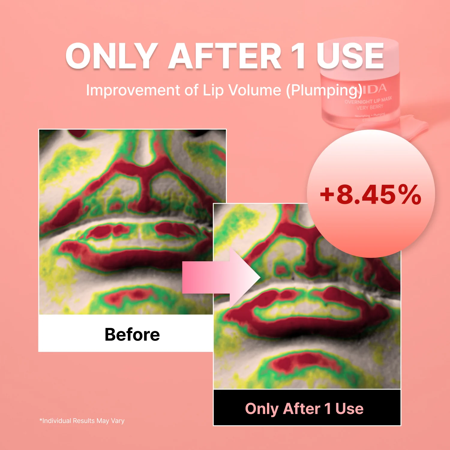 NIDA Ultimate Lip Care Set (Lip Serum + Lip Mask) - Image 5