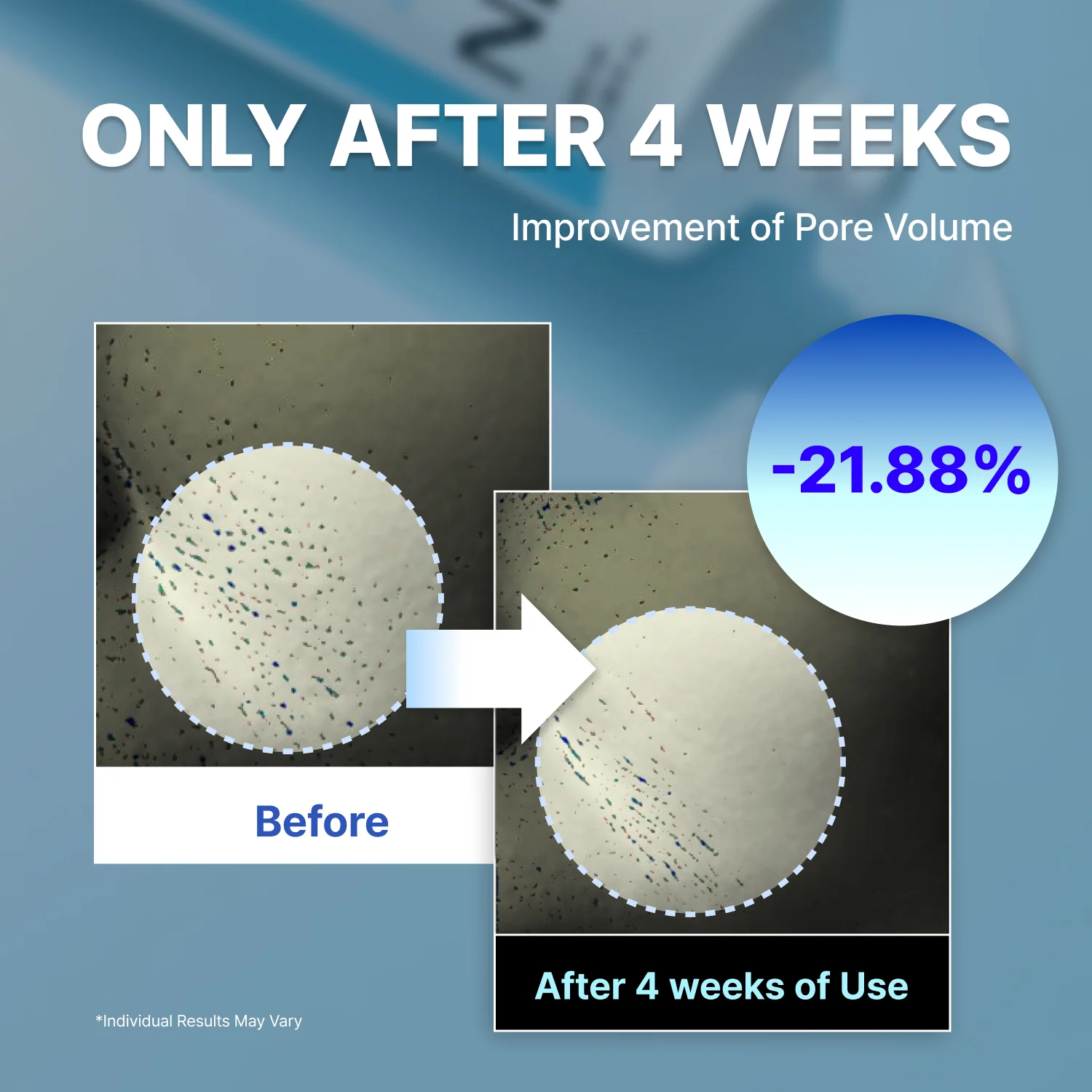 NIDA Youthful Formula™ Ultimate Moisturizing Cream - Image 4